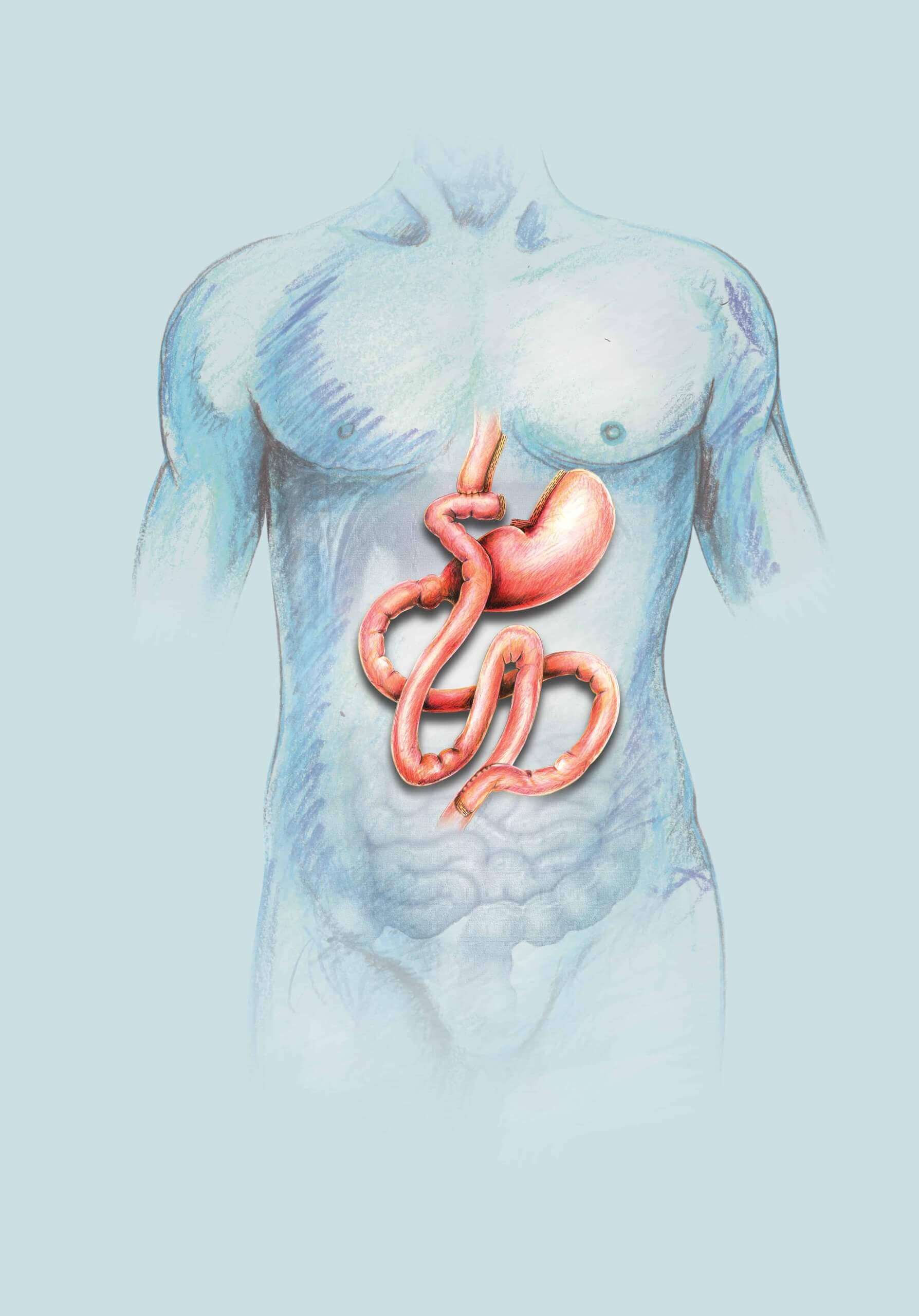 bypass-scaled-1 eating out after bariatric surgery